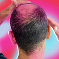 Hair Care Routine for Managing Male Pattern Baldness