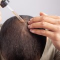 Understanding Minoxidil: A Guide to Preventing Hair Loss and Promoting Hair Growth