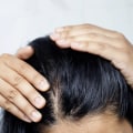 Understanding Menopause and Hair Loss