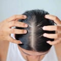 Understanding Hormonal Imbalances and Hair Loss