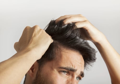 Iron-Deficiency Anemia and Hair Loss: Understanding the Link