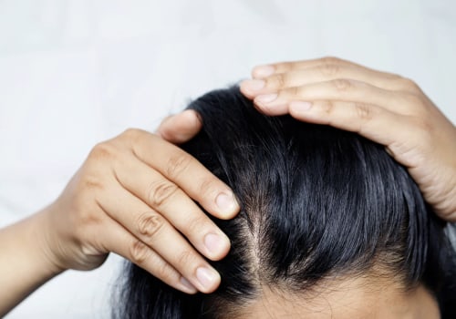 Understanding Menopause and Hair Loss